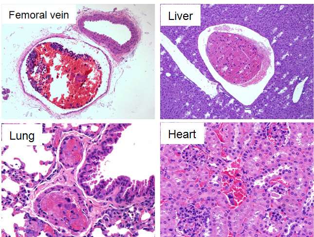 vascular congestion and/or thrombosis in Hematoxylin & Eosin (H&E) staining of each tissue in mouse mesenchymal stem cells injected mice