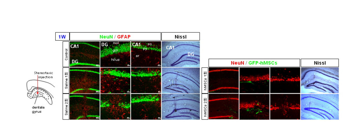 흰쥐 대뇌 해마 DG부위로의 기계적 정위 미세 주입 1주 후 신경세포 손상 및 성상세포 활성화 확인