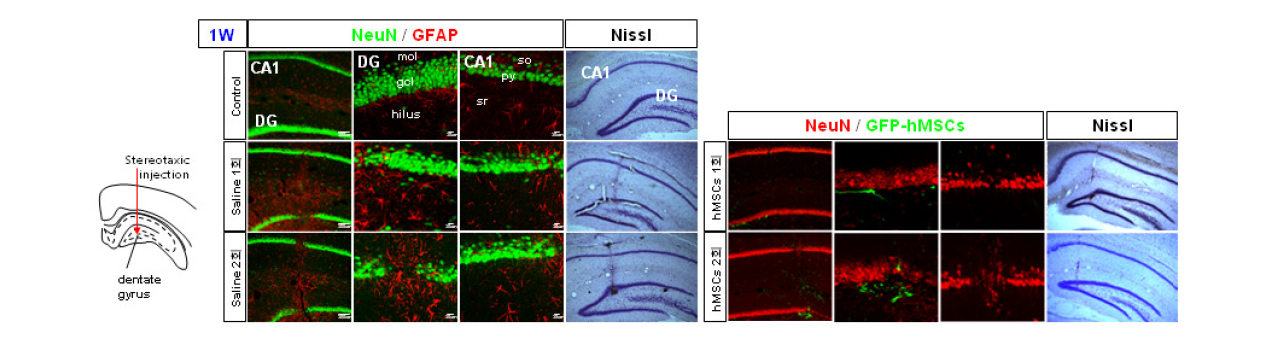 흰쥐 대뇌 해마 DG부위로의 기계적 정위 미세 주입 1주 후 신경세포 손상 및 성상세포 활성화 확인