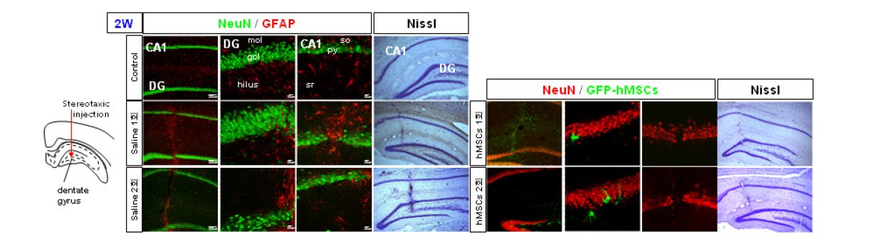 흰쥐 대뇌 해마 DG부위로의 기계적 정위 미세 주입 2주 후 신경세포 손상 및 성상세포 활성화 확인