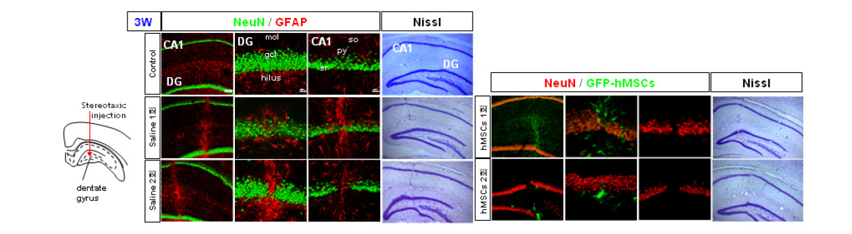 흰쥐 대뇌 해마 DG부위로의 기계적 정위 미세 주입 3주 후 신경세포 손상 및 성상세포 활성화 확인