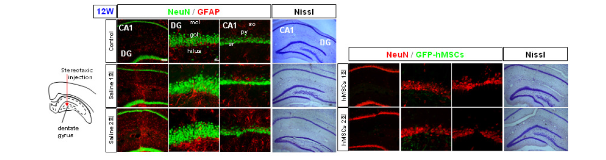 흰쥐 대뇌 해마 DG부위로의 기계적 정위 미세 주입 12주 후 신경세포 손상 및 성상세포 활성화 확인