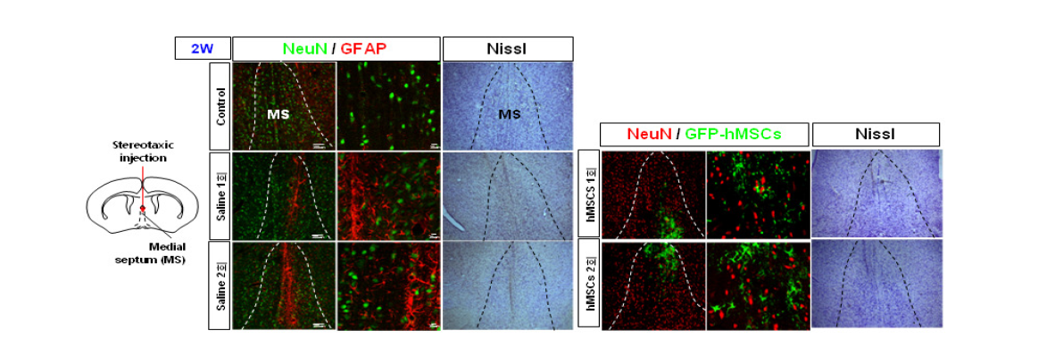 흰쥐 대뇌 기저부 MS 부위로의 기계적 정위 미세 주입 2주 후 신경세포 손상 및 성상세포 활성화 확인