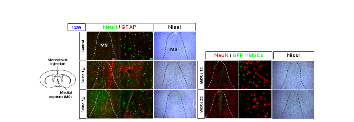 흰쥐 대뇌 기저부 MS 부위로의 기계적 정위 미세 주입 12주 후 신경세포 손상 및 성상세포 활성화 확인. 줄기세포 주입 후 성상세포 활성화 감소함