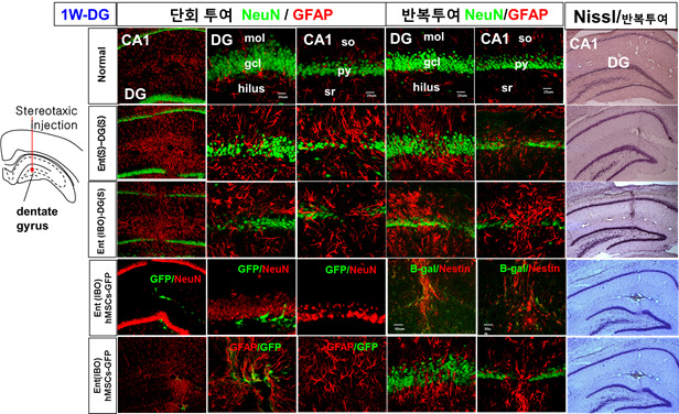 퇴행성 뇌질환 흰쥐 모델 뇌의 DG부위로 기계적 정위 미세주입 1주후 신경계조직 손상 및 성상세포 활성화. Nissl 염색에서 바늘 흔적과 이식된 세포가 염색됨