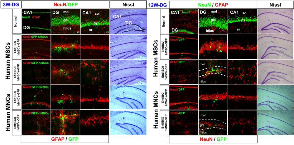 hMSC와 비교하여 hMNCs를 뇌질환 모델 흰쥐 DG에 이식한 3-12 주후 신경조직손상 및 줄기세포 편입과 분화 확임함