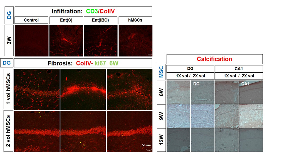 퇴행성 뇌질환 동물모델 흰쥐 DG hilus부위로 1.2x105 (1 vol)과 2.4x105 cells (2vol) hMSCs 기계적 정위주입후 3-12주 후 면역세포 infiltration, Fibrosis, calcification조사.