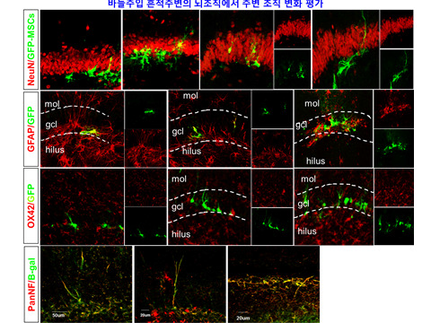 GFP-MSCs나 b-GAL-adenovirus로 표지하여 뇌이식한 hMSCs의 분화 여부조사. NeuN, panNF-신경세포, GFAP-성상세포 및 NSCs와 OX42-소교세포 표지함.