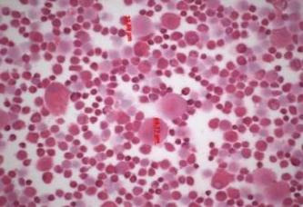 연구에 사용한 mesenchymal stel cell (H&E 염색).