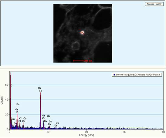 SiO2ENB20,(-)를 경피투여한 rat의 hippocampus STEM사진(위쪽), EDS 분석 결과(아래쪽)