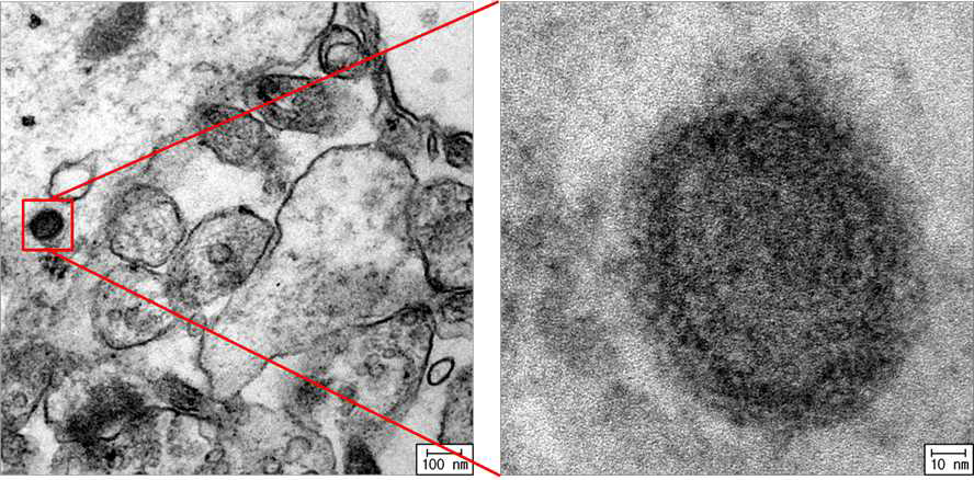 SiO2100,(-)경피투여군의 hippocampus TEM사진(오른쪽), 의심되는 물질 확대 사진(왼쪽)