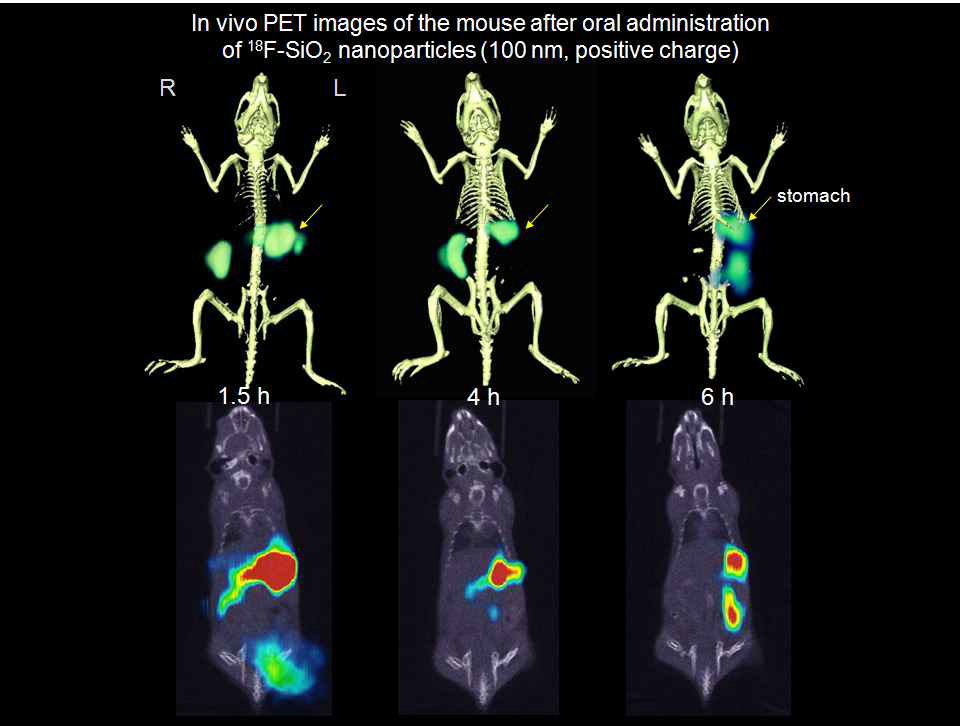 18F-SiO2ENB100,(+) 나노입자 경구 투여 후 in vivo PET/CT images.