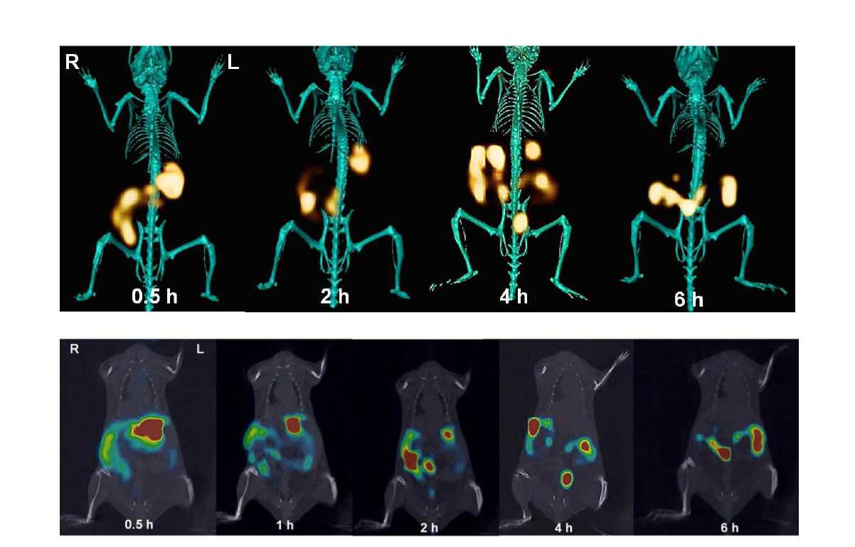 18F-SiO2ENB20,(+) 나노입자 경구 투여 후 in vivo PET/CT images.