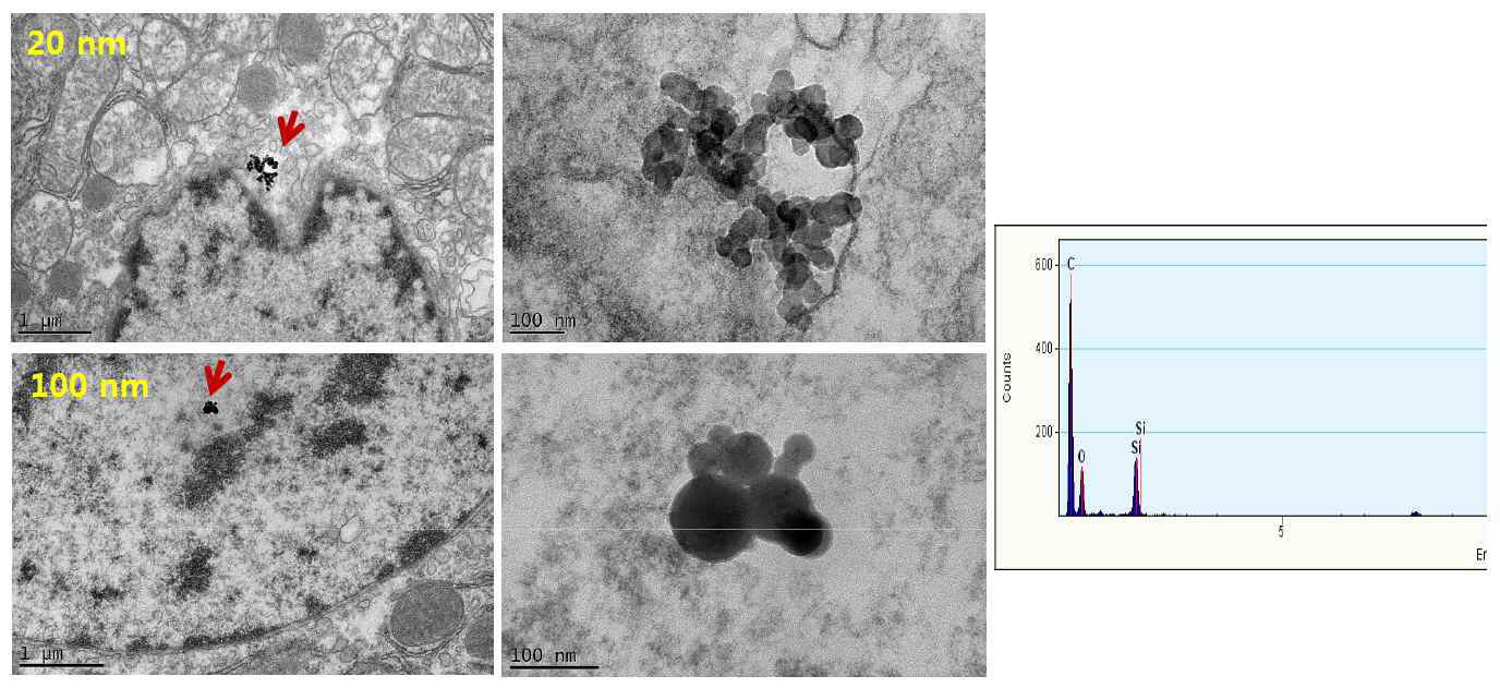 Transmission electron microscopy를 통한 실리카 나노물질의 liver에서의 형상 관찰 결과