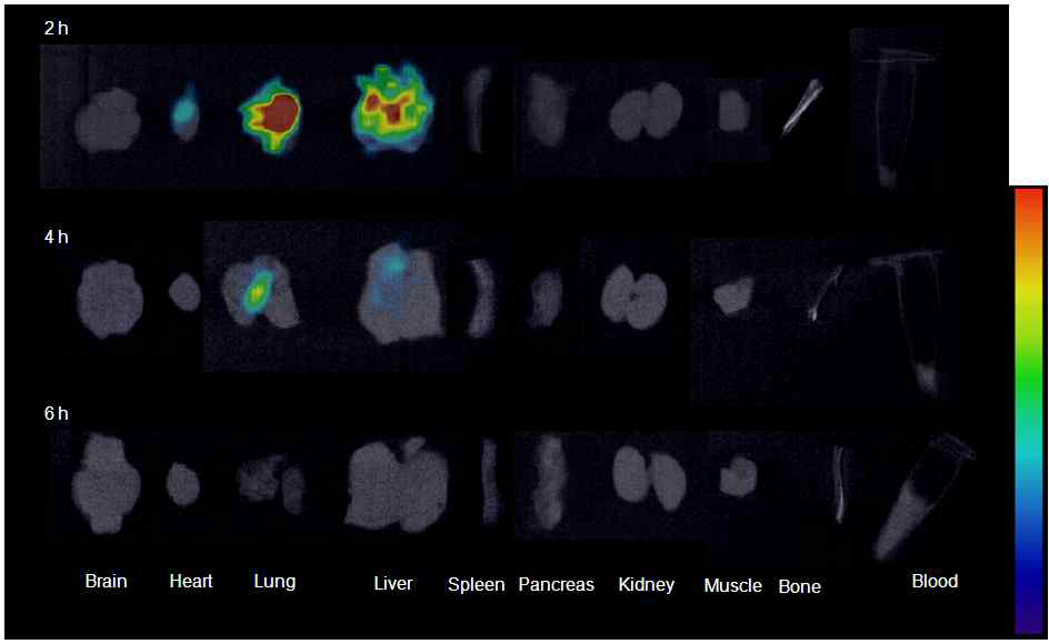 18F-SiO2ENB,100,(-) 나노입자 경구 투여 후 마우스의 ex vivo PET-CT fusion images.