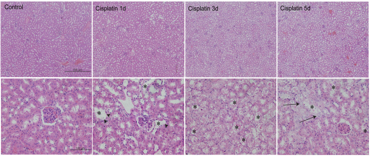 Cisplatin 단회 투여에 의한 신장조직 손상 (H&E staining)
