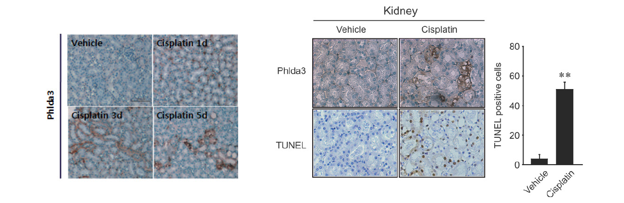 Immunohistochemistry for renal Phlda3 and TUNEL staining after cisplatin treatment