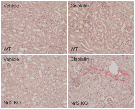 Induction of renal fibrosis by cisplatin in Nrf2 KO mouse