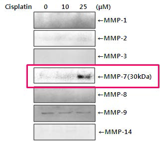 Cisplatin에 의한 MMPs 발현 변화 관찰 : HK-2 cells