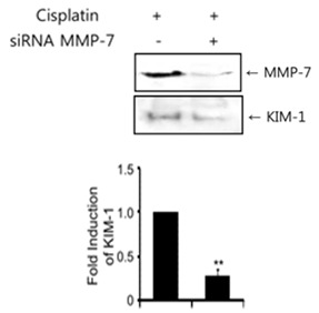 MMP-7 knockdown에 따른 KIM-1 sheedding 변화 관찰 : HK-2 cells