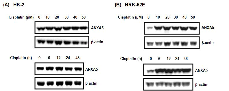 신장세포에서의 cisplatin 처리에 따른 annexin a5의 발현 확인