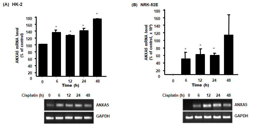 신장 세포에서의 cisplatin 에 의한 annexin A5 mRNA 발현확인