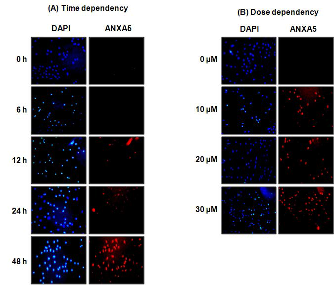HK-2 cell에서 cisplatin의 처리에 따른 annexin A5 의 발현 확인 (Immunofluorescence)