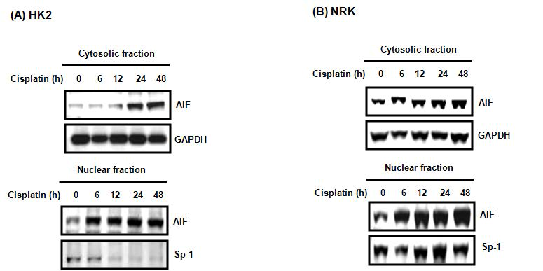 HK-2 cell에서의 cisplatin 처리 후 AIF translocation확인