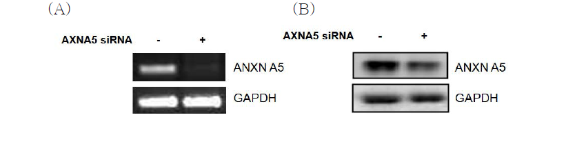 HK-2 cell에서 annexin A5 siRNA에 의한 gene knockdown 확인.