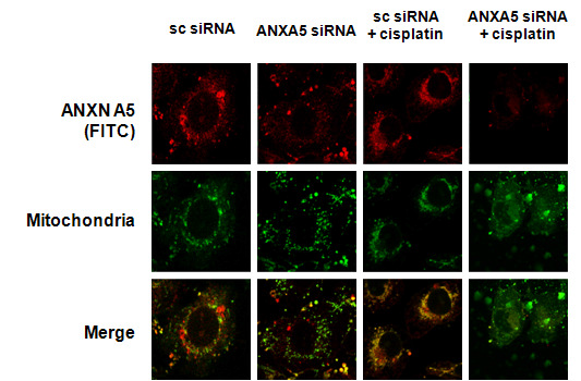 HK-2 cell에서의 cisplatin에 의한 annexin A5 translocation 확인 : Immunofluorescence