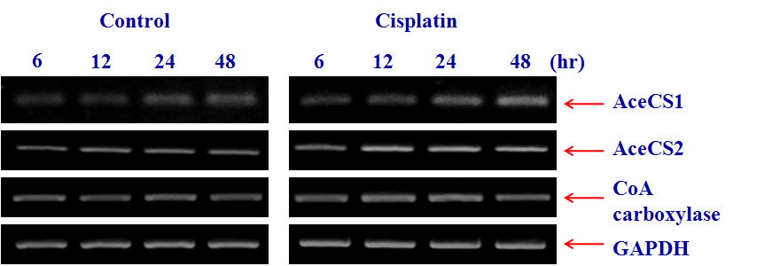 Effects of cisplatin on the expression of Sirt proteins in HK-2 cells treated with cisplatin 5 μM