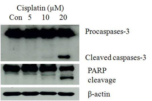 NRK-52 cell에 cisplatin을 처리한 후 apoptotic cell death 기전에 미치는 영향