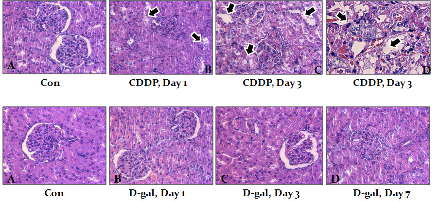 Cisplatin (20mg/kg)및 D-galactosamine (50mg/kg)을 투여한 Sprague-Dawley 랫드의 신장에서 병리조직학적 변화