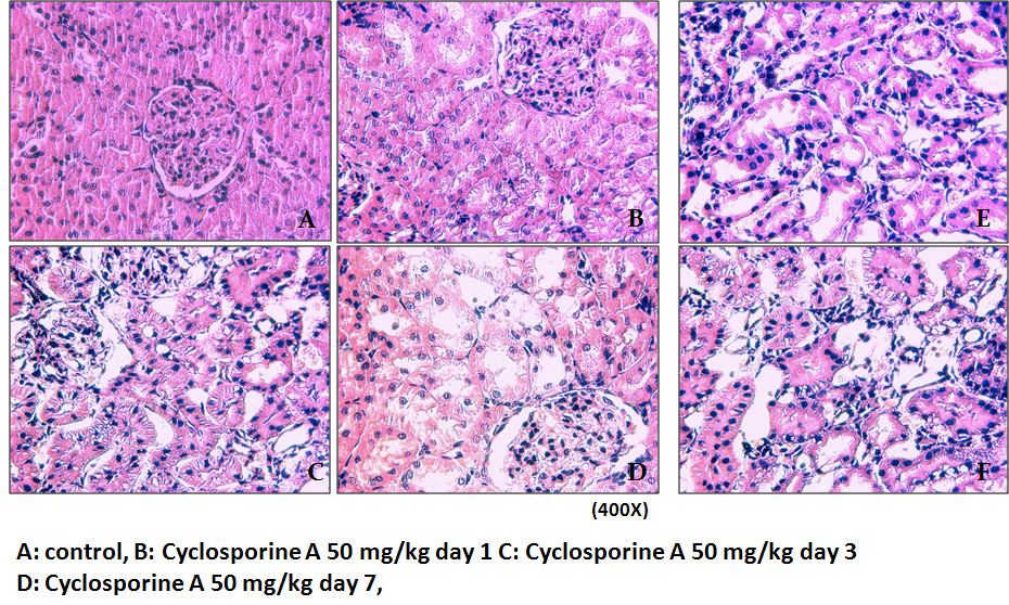 Cyclosporine A(50mg/kg)을 투여한 Sprague-Dawley rats에서 신장의 조직학적 변화