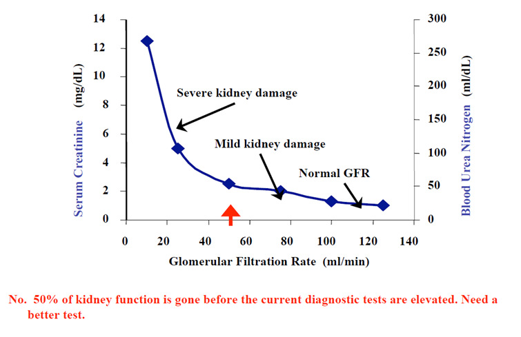 Comparisons of sensitive biomarkers on acute kidney damages