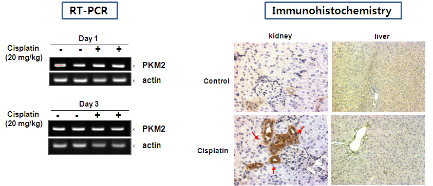 Cisplatin을 주사한 쥐의 신장 조직에서 PKM2, EF-1γ의 발현 변화 - RT-PCR, Immunohistochemistry