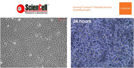 The morphology of human primary isolated hepatocytes