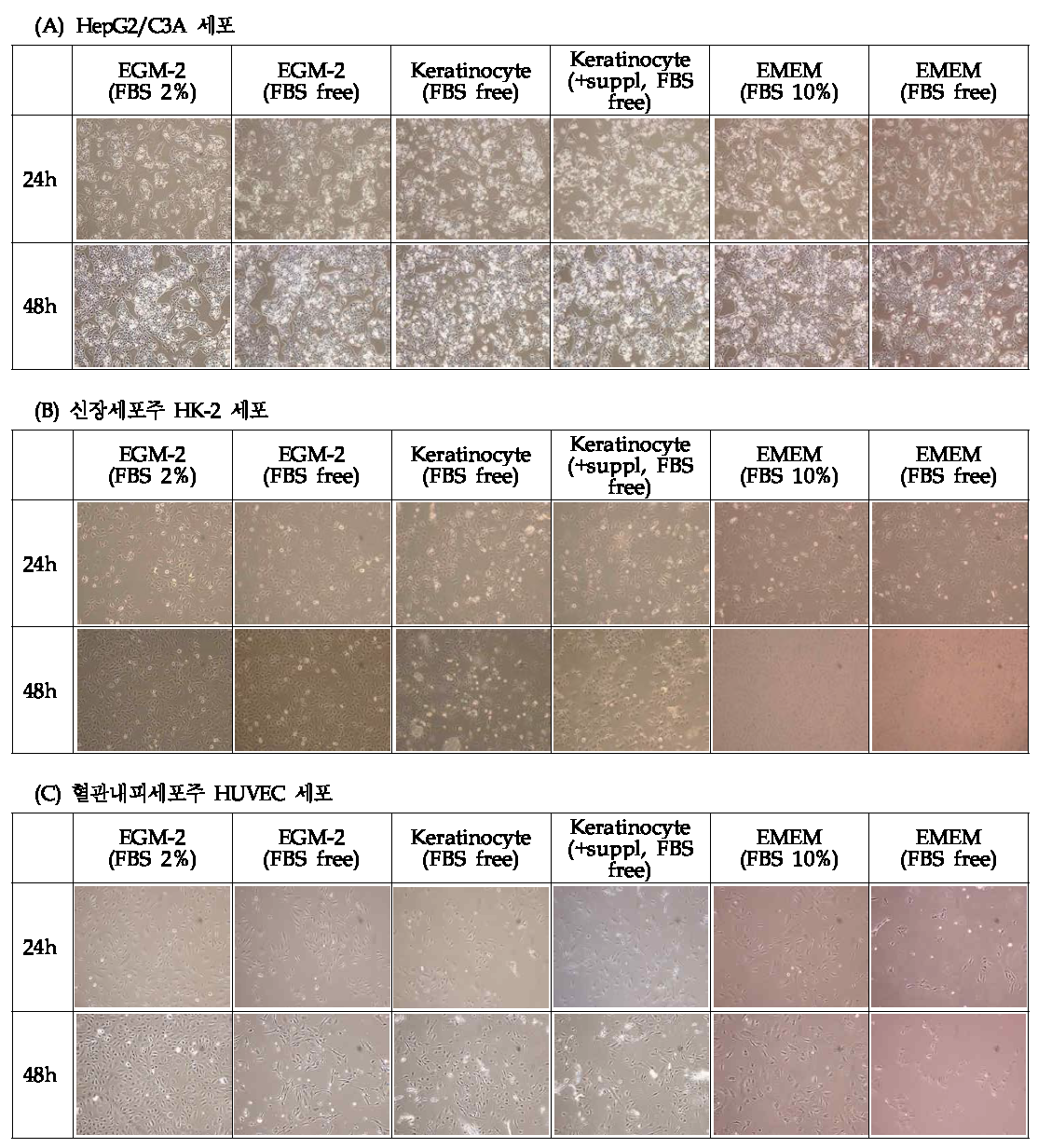 Cell morphology of (A) HepG2/C3A, (나) HK-2, (다) HUVEC cells in 6 different media