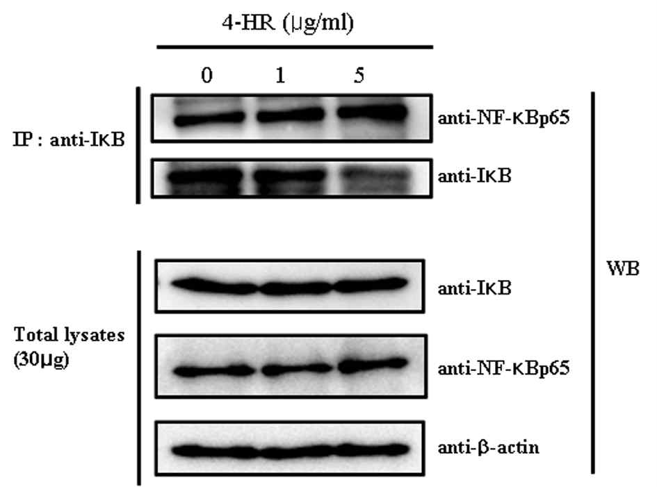 KB cell에 4-HR을 가하고 면역침 적법에 의하여 NF-kB pathway 관련 단백 질의 발현을 관찰한 소견