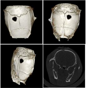 두개골의 Micro-CT 사진