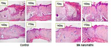 실크 나노섬유막의 생체적합성 및 창상 치유 효과 확인 (H&E 염색).