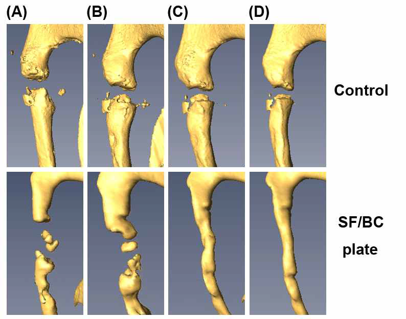 협골궁 골절 후 SF/BC 플레이트에 의한 뼈 재생 3D micro-CT 이미지
