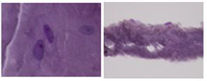 인공 근막용 실크 나노섬유막에서의 human condrocyte 배양 (14일).