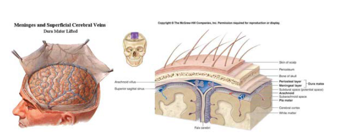 뇌경막 구조를 묘사한 일러스트.