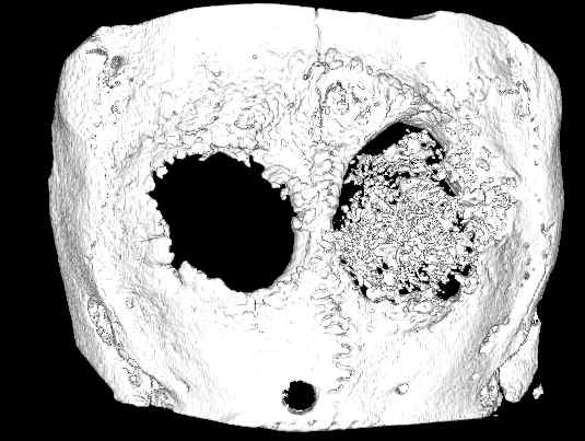 토끼의 두개골에 아무것도 이식하지 않은 경우 (대조구, 무처리) (좌)와 실크/하이드 록시아파타이트 유무기 복합 나노섬유 지지체 이식한 경우 (우) 12주 후 촬영한 micro-CT 사진.