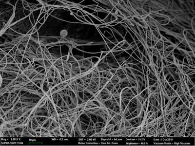 진피용 실크 나노섬유 3차원 지지체의 전계방출 주사전자현미경 사진.