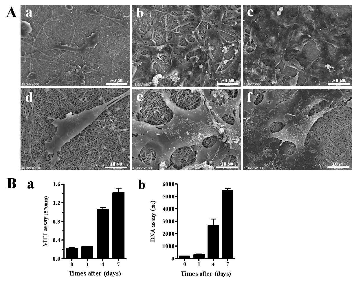 신경 섬유초 세포 1, 4, 7일 배양 후의 주사전자현미경 사진, MTT 및 DNA 분석 결과