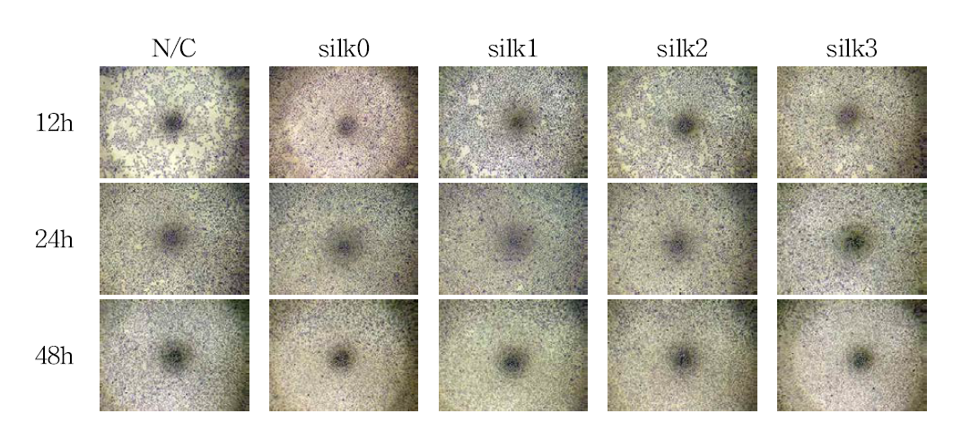 가수분해 실크와의 혼합 세포 배양액에 배양한 HaCaT 세포의 형태 관찰