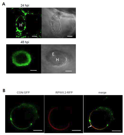 Golovinomyces orontii 침입에 의한 CON:GFP의 localization 변화