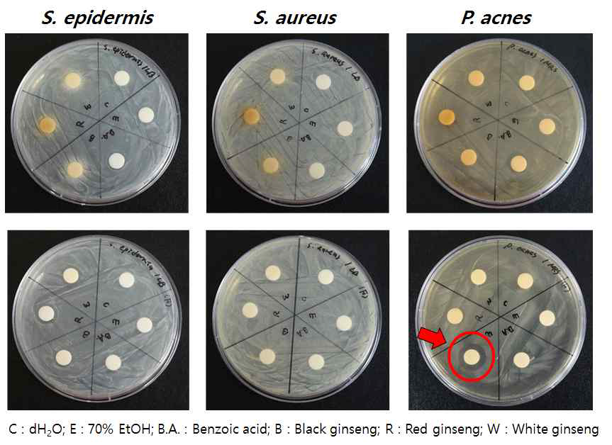 Antibacterial activity against pathogens of acne